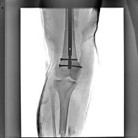 Скачать песню Kaka Byaka - Показала